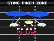 3 4 over sting pinch zone 1