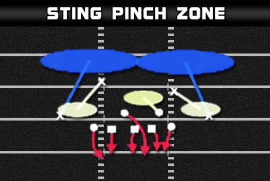 3-4 Over – Sting Pinch Zone 3 4 over sting pinch zone 1