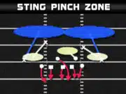 3-4 Over – Sting Pinch Zone 3 4 over sting pinch zone