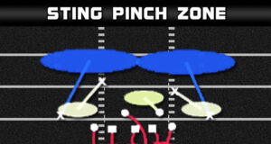 3 4 over sting pinch zone